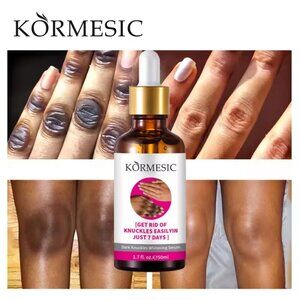 Strong Whitening Lightening Cream for Dark Spots dark knees & elbows-Fast Result